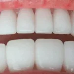 teeth teeth