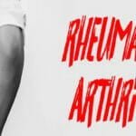 rheumatoid arthritis