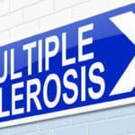 multiple sclerosis