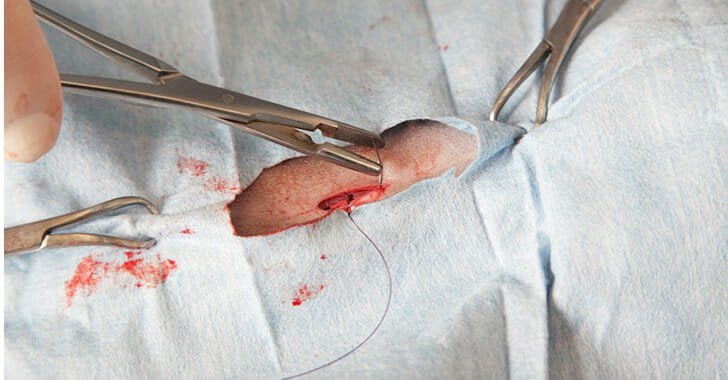 Stitching up a small laceration