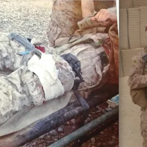 Removing-the-RPG6 Removing the RPG