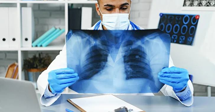 Doctor looking at a Chest X-Ray
