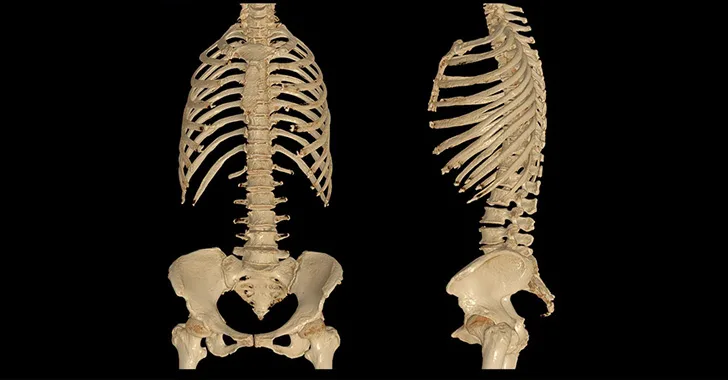 CT scan of whole spine 3D rendering showing Profile Human Spine.