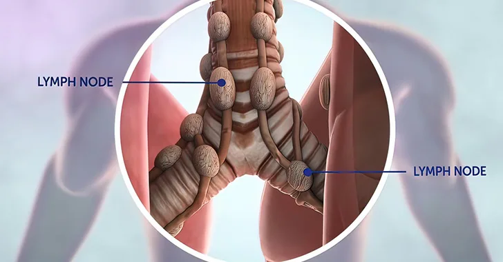 My Lymph Nodes are swollen My Lymph Nodes are swollen