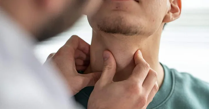 swollen lymph nodes in neck