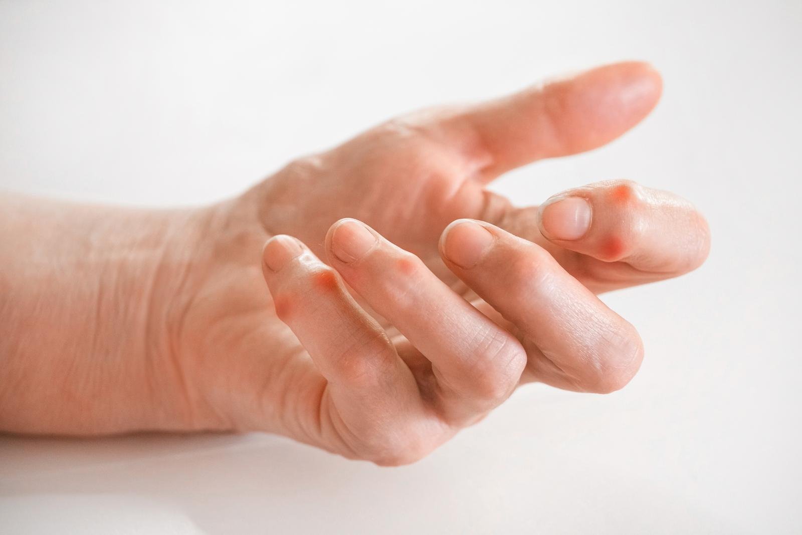 Sick female fingers of an elderly man's hand on a white